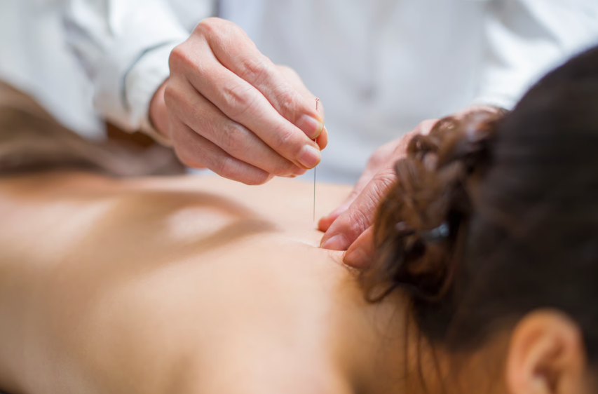 Acupuncture in Lansdale, PA - July 28th, 2026
